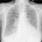 Radiologie Quiz 51